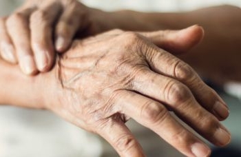 SUS terá primeiro medicamento para demência associada ao Parkinson