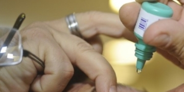 Mutirão oferece 150 exames gratuitos de glaucoma e catarata