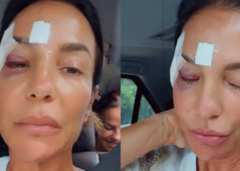 Ivete Sangalo recebe alta de hospital em Salvador após acidente e fala sobre diagnóstico